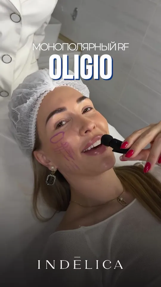 RF-лифтинг Oligio
