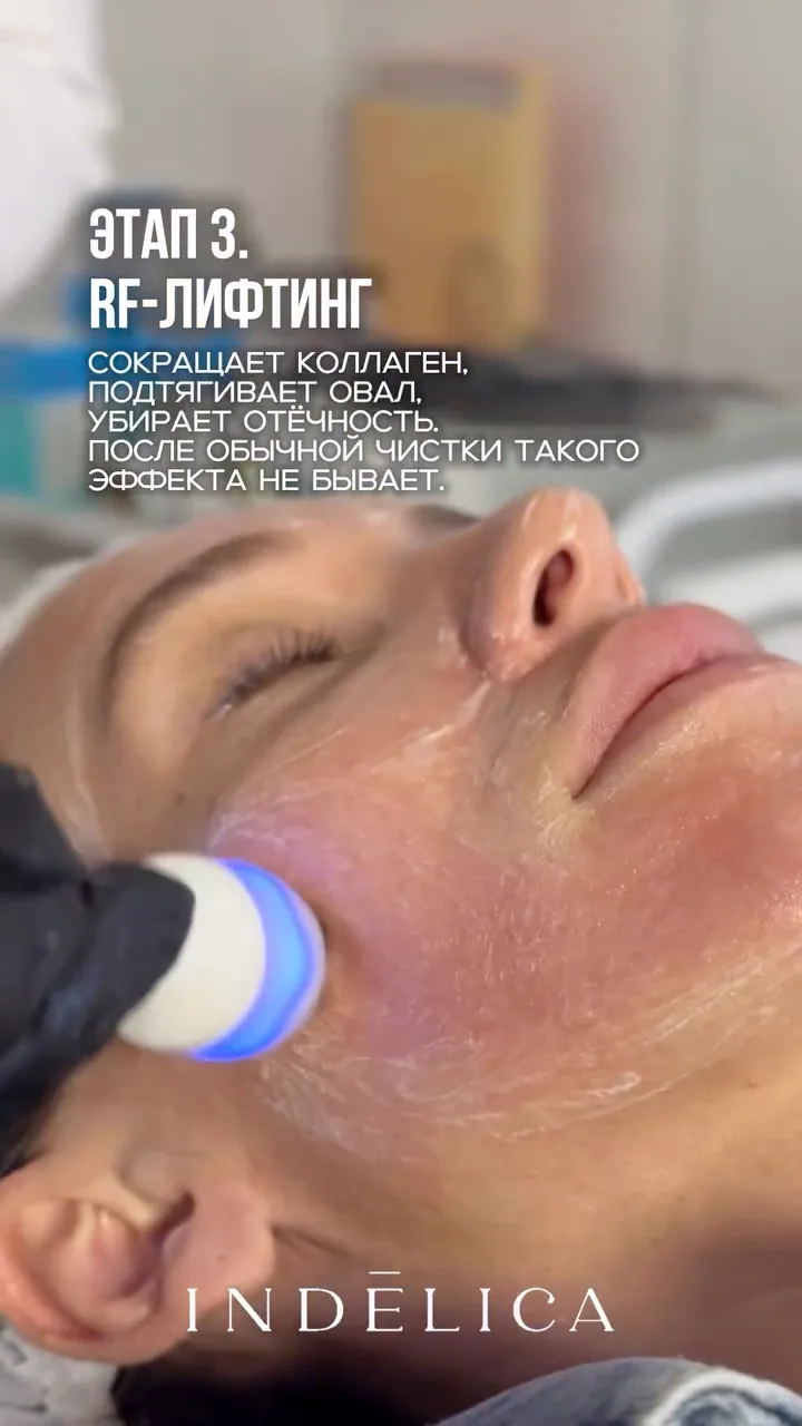 Чистка ProFacial