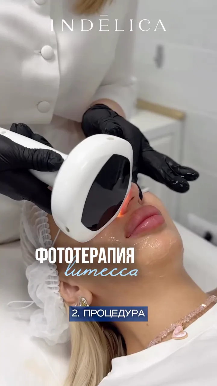 Фотоомоложение Lumecca